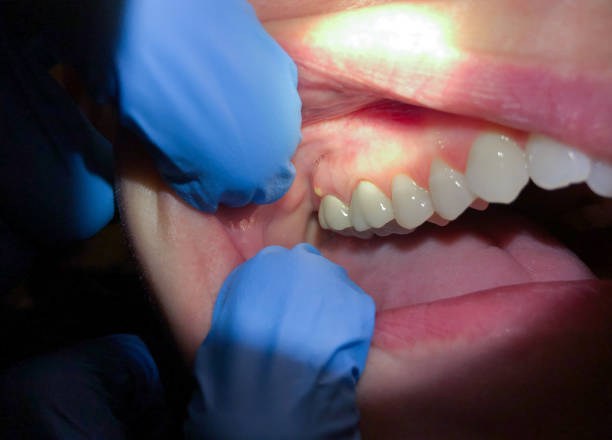 Best Orthodontic Emergency Dentist in Fussels Corner, FL