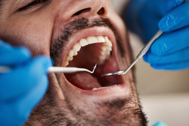 Best Broken or Cracked Tooth Emergency Dentist in Fussels Corner, FL