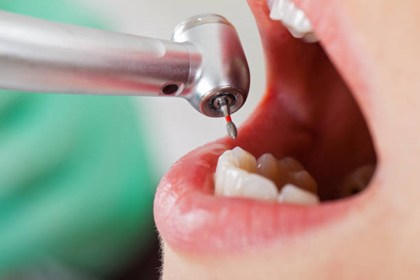 Best Mobile Emergency Dentist in Fussels Corner, FL